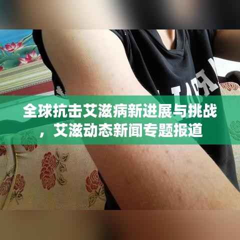 全球抗击艾滋病新进展与挑战,艾滋动态新闻专题报道