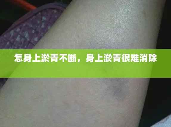 怎身上淤青不断,身上淤青很难消除