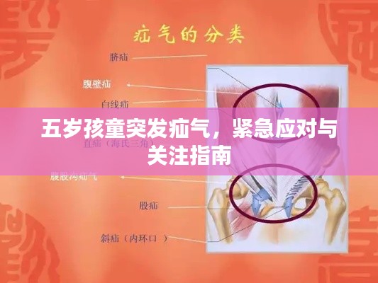 五岁孩童突发疝气,紧急应对与关注指南