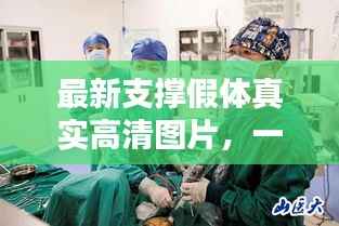 最新支撑假体真实高清图片,一窥现代医疗科技的惊人进步