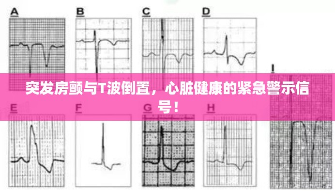 突发房颤与T波倒置,心脏健康的紧急警示信号!