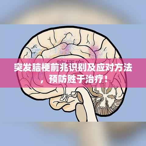 突发脑梗前兆识别及应对方法,预防胜于治疗!