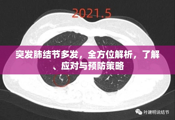 突发肺结节多发,全方位解析,了解、应对与预防策略